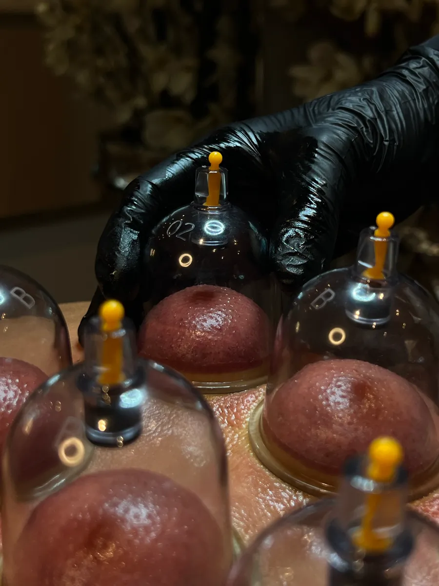 Cupping body shaping-behandeling bij Pure Body Bliss