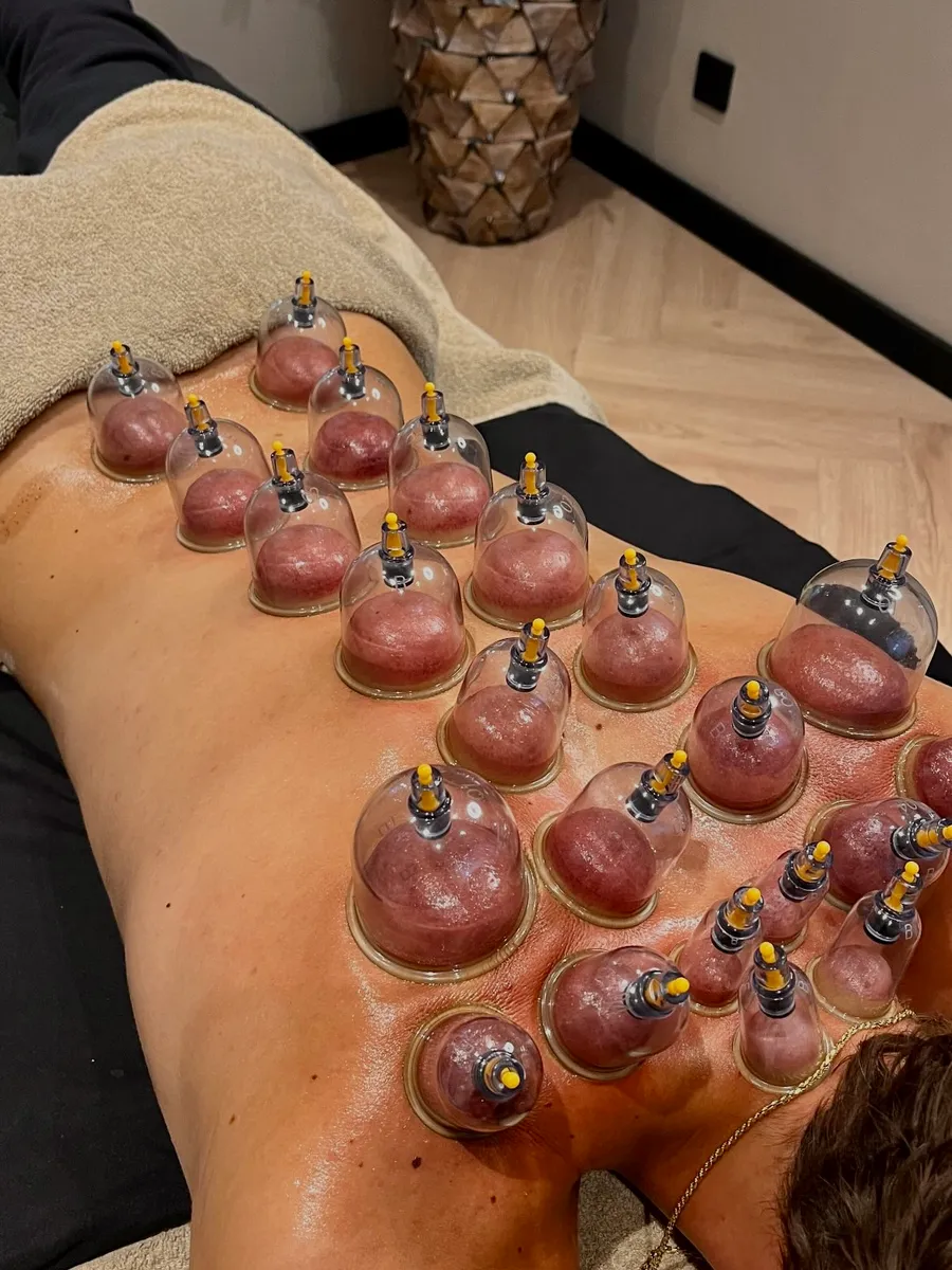 Cupping-behandeling bij Pure Body Bliss in Fijnaart
